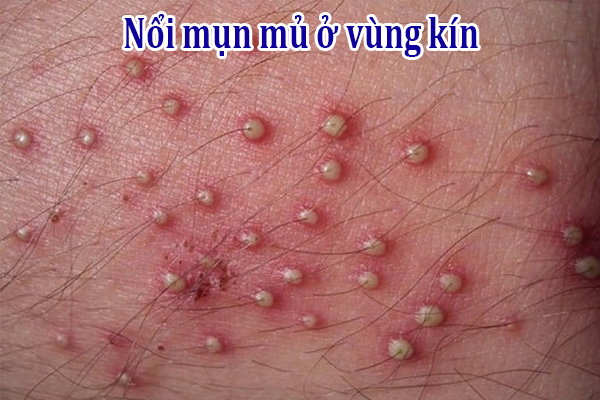 Hình ảnh minh họa